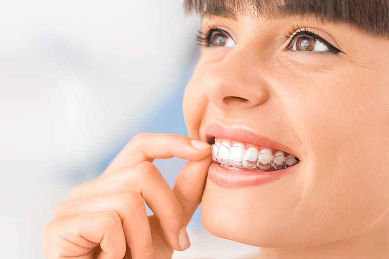 Invisalign in Lutherville-Timonium